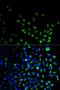 Ubiquitin C-Terminal Hydrolase L1 antibody, LS-C331927, Lifespan Biosciences, Immunofluorescence image 