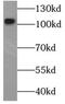 Selectin P antibody, FNab06852, FineTest, Western Blot image 
