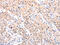 TRAP antibody, CSB-PA034758, Cusabio, Immunohistochemistry paraffin image 