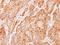 Endoplasmic Reticulum Protein 44 antibody, NBP1-32495, Novus Biologicals, Immunohistochemistry frozen image 