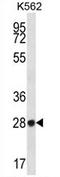 Zinc Finger Protein 146 antibody, AP54671PU-N, Origene, Western Blot image 