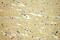 Vezatin, Adherens Junctions Transmembrane Protein antibody, 17684-1-AP, Proteintech Group, Immunohistochemistry paraffin image 