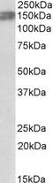 ALK Receptor Tyrosine Kinase antibody, EB11052, Everest Biotech, Western Blot image 