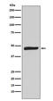 MAPK Activated Protein Kinase 2 antibody, M01193-1, Boster Biological Technology, Western Blot image 