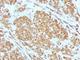 Melan-A antibody, NBP2-44391, Novus Biologicals, Immunohistochemistry frozen image 