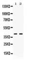 PSA antibody, PA5-79888, Invitrogen Antibodies, Western Blot image 