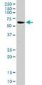 ADP Ribosylation Factor GTPase Activating Protein 2 antibody, H00084364-D01P, Novus Biologicals, Western Blot image 