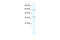 Zinc Finger And BTB Domain Containing 7A antibody, 28-380, ProSci, Enzyme Linked Immunosorbent Assay image 