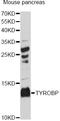 TYRO Protein Tyrosine Kinase Binding Protein antibody, LS-C749774, Lifespan Biosciences, Western Blot image 