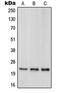 Parkinsonism Associated Deglycase antibody, LS-C353340, Lifespan Biosciences, Western Blot image 