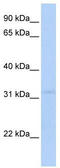 Mitochondrial Carrier 2 antibody, TA334520, Origene, Western Blot image 