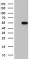 TIMELESS Interacting Protein antibody, M08219, Boster Biological Technology, Western Blot image 