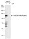 Protein Tyrosine Kinase 2 antibody, GTX132320, GeneTex, Western Blot image 