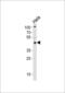 Thyroid Hormone Receptor Interactor 13 antibody, MBS9204416, MyBioSource, Western Blot image 