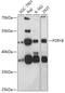 P2Y Receptor Family Member 8 antibody, 18-132, ProSci, Western Blot image 