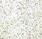 Histone Deacetylase 3 antibody, PA1600-1, Boster Biological Technology, Immunohistochemistry frozen image 