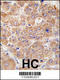 UV Radiation Resistance Associated antibody, LS-C160494, Lifespan Biosciences, Immunohistochemistry paraffin image 