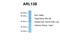 ADP Ribosylation Factor Like GTPase 13B antibody, NBP1-56715, Novus Biologicals, Western Blot image 