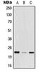 Mediator Complex Subunit 29 antibody, orb215575, Biorbyt, Western Blot image 