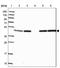 Gamma-Aminobutyric Acid Type A Receptor Delta Subunit antibody, NBP2-33421, Novus Biologicals, Western Blot image 