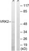 VRK Serine/Threonine Kinase 2 antibody, LS-C120375, Lifespan Biosciences, Western Blot image 