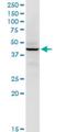 Replication Factor C Subunit 5 antibody, H00005985-M01, Novus Biologicals, Western Blot image 