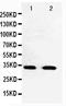 Cyclin Dependent Kinase 5 antibody, PA1548, Boster Biological Technology, Western Blot image 