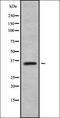 C-Type Lectin Domain Containing 6A antibody, orb336367, Biorbyt, Western Blot image 