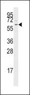 Transforming Growth Factor Beta Receptor 1 antibody, PA5-14959, Invitrogen Antibodies, Western Blot image 