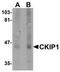 Pleckstrin Homology Domain Containing O1 antibody, TA306854, Origene, Western Blot image 