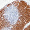 DNA Nucleotidylexotransferase antibody, LS-C87536, Lifespan Biosciences, Immunohistochemistry frozen image 