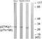 Cyclin Dependent Kinase Inhibitor 1B antibody, LS-C199369, Lifespan Biosciences, Western Blot image 