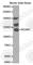 Neural Cell Adhesion Molecule 1 antibody, A0393, ABclonal Technology, Western Blot image 