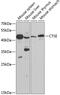 Cathepsin E antibody, GTX33064, GeneTex, Western Blot image 