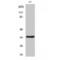 Aquaporin 4 antibody, LS-C382089, Lifespan Biosciences, Western Blot image 
