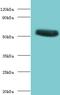 Torpedo californica Acetylcholine R subunit alpha  antibody, orb241374, Biorbyt, Western Blot image 