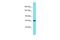 Hemicentin 2 antibody, A17025, Boster Biological Technology, Western Blot image 