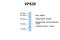 VPS29 Retromer Complex Component antibody, ARP56858_P050, Aviva Systems Biology, Western Blot image 