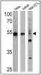 Peroxisome Proliferator Activated Receptor Alpha antibody, NB300-537, Novus Biologicals, Western Blot image 