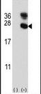 Fatty acid-binding protein, heart antibody, PA5-13461, Invitrogen Antibodies, Western Blot image 