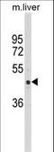 Rho GTPase Activating Protein 25 antibody, LS-C156471, Lifespan Biosciences, Western Blot image 