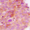 Insulin Receptor Substrate 1 antibody, GTX32202, GeneTex, Immunohistochemistry paraffin image 