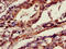 Annexin A10 antibody, LS-C498392, Lifespan Biosciences, Immunohistochemistry frozen image 