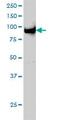 Ubiquitin Like With PHD And Ring Finger Domains 1 antibody, ab57083, Abcam, Western Blot image 