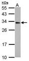 Hydroxysteroid 17-Beta Dehydrogenase 3 antibody, PA5-30063, Invitrogen Antibodies, Western Blot image 