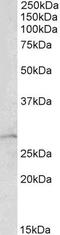 Rho GDP Dissociation Inhibitor Alpha antibody, PA5-19353, Invitrogen Antibodies, Western Blot image 