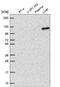Dehydrogenase E1 And Transketolase Domain Containing 1 antibody, NBP2-57835, Novus Biologicals, Western Blot image 