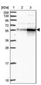 Cyclase Associated Actin Cytoskeleton Regulatory Protein 2 antibody, PA5-62206, Invitrogen Antibodies, Western Blot image 