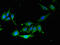 RAB5A, Member RAS Oncogene Family antibody, CSB-PA019213EA01HU, Cusabio, Immunofluorescence image 