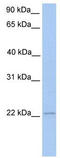 Interferon-stimulated gene 20 kDa protein antibody, TA345795, Origene, Western Blot image 
